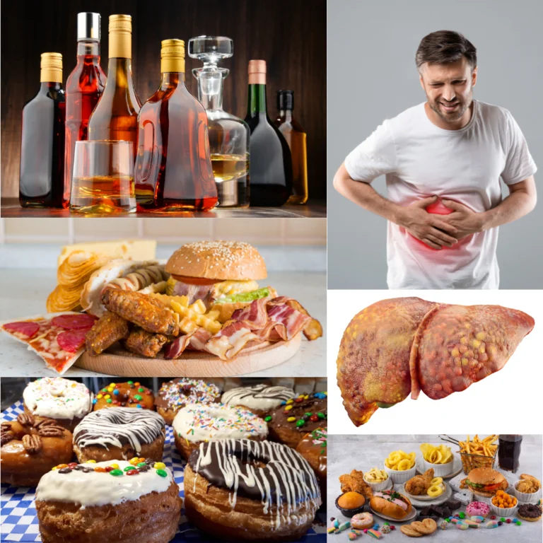 Májproblémák okai – alkohol, zsírban gazdag ételek, cukros desszertek